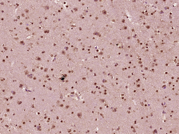 HSF1 Rabbit Polyclonal Antibody