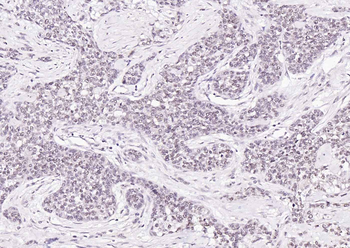 HSF1 Rabbit Polyclonal Antibody