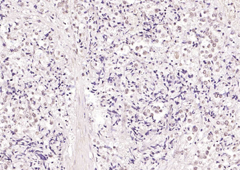 HSF1 Rabbit Polyclonal Antibody