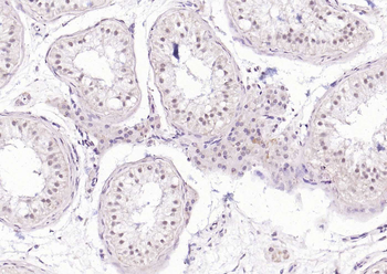 HSF1 Rabbit Polyclonal Antibody