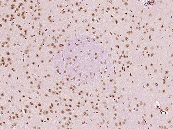 HSF1 Rabbit Polyclonal Antibody