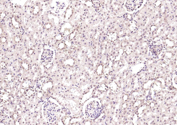 HSF1 Rabbit Polyclonal Antibody