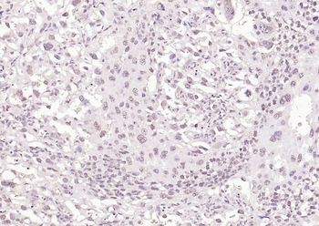 HSF1 Rabbit Polyclonal Antibody