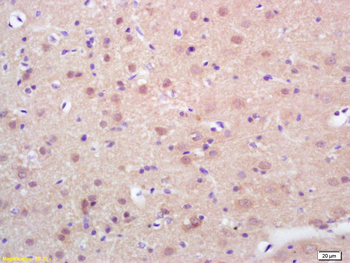 Phospho-HSF1 (Ser326) Rabbit Polyclonal Antibody