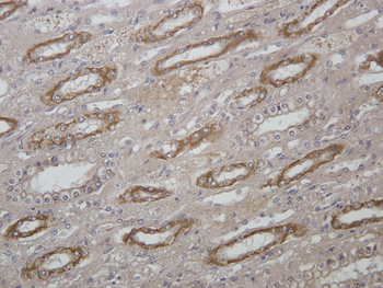 HSD11B1 Rabbit Polyclonal Antibody