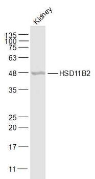 HSD11B2 Rabbit Polyclonal Antibody