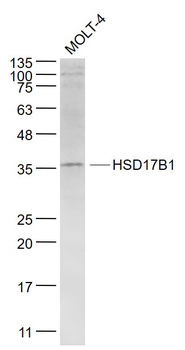 HSD17B1 Rabbit Polyclonal Antibody