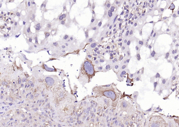 HSD3B1 Rabbit Polyclonal Antibody