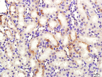HSD3B1 Rabbit Polyclonal Antibody