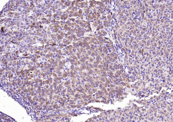 HSD3B1 Rabbit Polyclonal Antibody