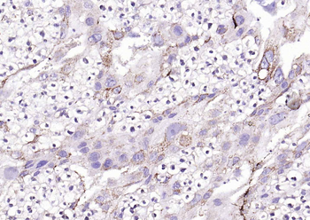 HSD3B1 Rabbit Polyclonal Antibody