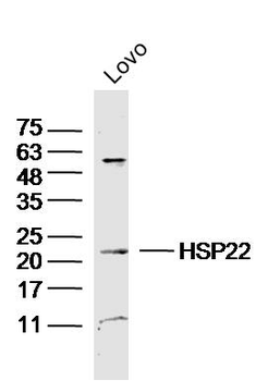 HSP22 Rabbit Polyclonal Antibody
