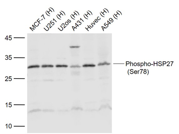 Phospho-HSP27 (Ser78) Rabbit Polyclonal Antibody