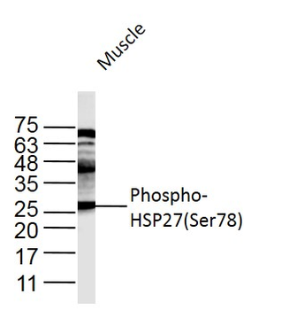 Phospho-HSP27 (Ser78) Rabbit Polyclonal Antibody