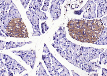 Phospho-HSP27 (Ser82) Rabbit Polyclonal Antibody