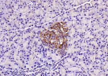 Phospho-HSP27 (Ser82) Rabbit Polyclonal Antibody