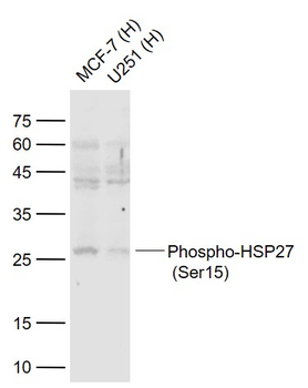 Phospho-HSP27 (Ser15) Rabbit Polyclonal Antibody