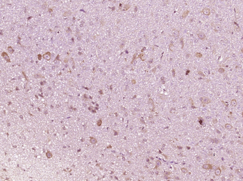 IFNAR1 Rabbit Polyclonal Antibody
