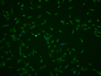 IFNAR1 Rabbit Polyclonal Antibody