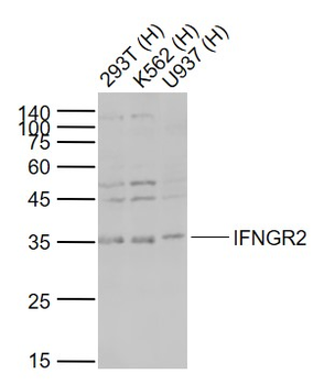 IFNGR2 Rabbit Polyclonal Antibody
