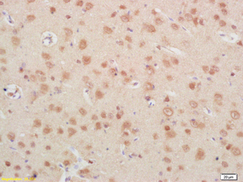IGFBP6 Rabbit Polyclonal Antibody