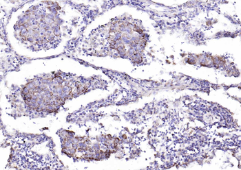 IKK alpha Rabbit Polyclonal Antibody