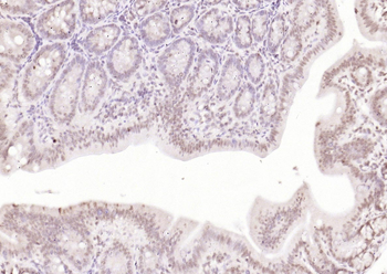 IKK alpha Rabbit Polyclonal Antibody