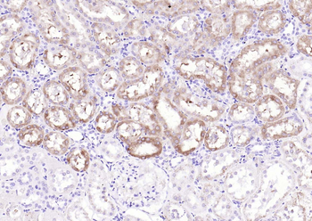 IKK alpha Rabbit Polyclonal Antibody