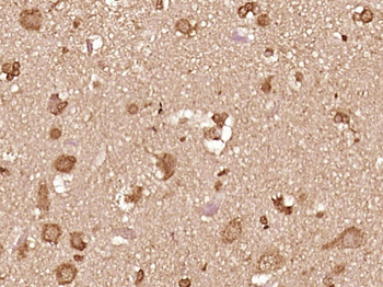 Phospho-IKK alpha (Thr23) Rabbit Polyclonal Antibody