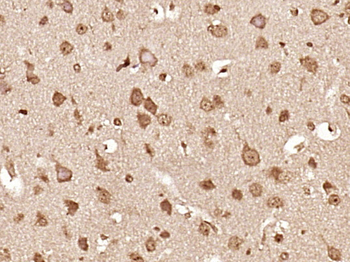 Phospho-IKK alpha (Thr23) Rabbit Polyclonal Antibody