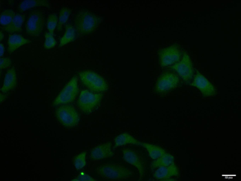 Phospho-IKK alpha/beta (Ser176 + Ser180) Rabbit Polyclonal Antibody