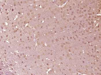 Phospho-IKK alpha/beta (Ser176 + Ser180) Rabbit Polyclonal Antibody