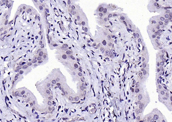 Phospho-IKK beta (Tyr188) Rabbit Polyclonal Antibody