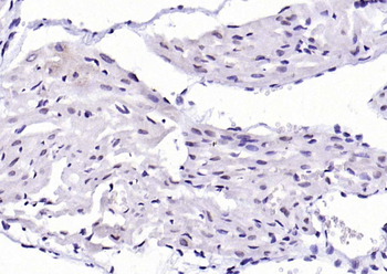 Phospho-IKK beta (Tyr188) Rabbit Polyclonal Antibody