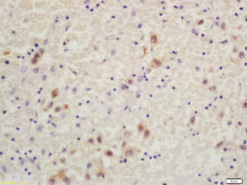 Phospho-IKK beta (Tyr188) Rabbit Polyclonal Antibody