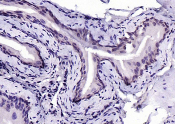 Phospho-IKK beta (Tyr199) Rabbit Polyclonal Antibody