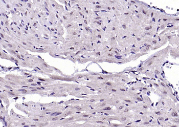 Phospho-IKK beta (Tyr199) Rabbit Polyclonal Antibody