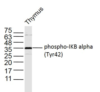 Phospho-IKB alpha (Tyr42) Rabbit Polyclonal Antibody