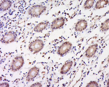 Phospho-IKB alpha (Tyr305) Rabbit Polyclonal Antibody