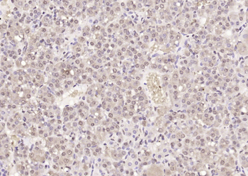 Phospho-IKB alpha (Tyr305) Rabbit Polyclonal Antibody