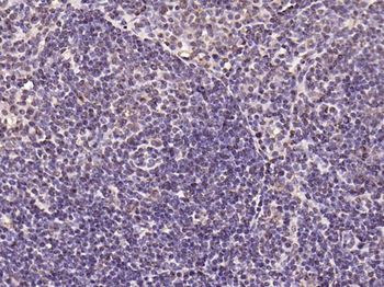 Phospho-IKB alpha (Tyr305) Rabbit Polyclonal Antibody