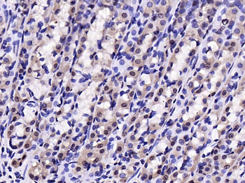 Phospho-IKB alpha (Tyr305) Rabbit Polyclonal Antibody