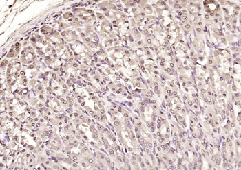 Phospho-IKB alpha (Tyr305) Rabbit Polyclonal Antibody