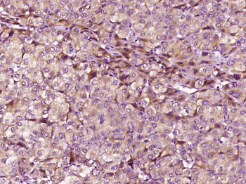 Phospho-IKK gamma (Ser31) Rabbit Polyclonal Antibody