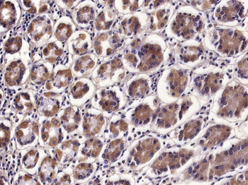 IL-17B Rabbit Polyclonal Antibody