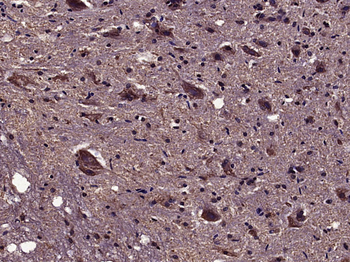 IL-17B Rabbit Polyclonal Antibody