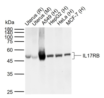 IL17RB Rabbit Polyclonal Antibody
