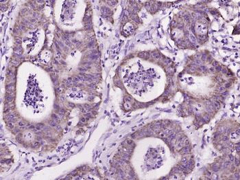 IL17C Rabbit Polyclonal Antibody