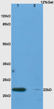 IL17C Rabbit Polyclonal Antibody
