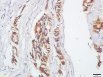IL17C Rabbit Polyclonal Antibody